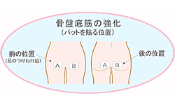 骨盤底筋の強化